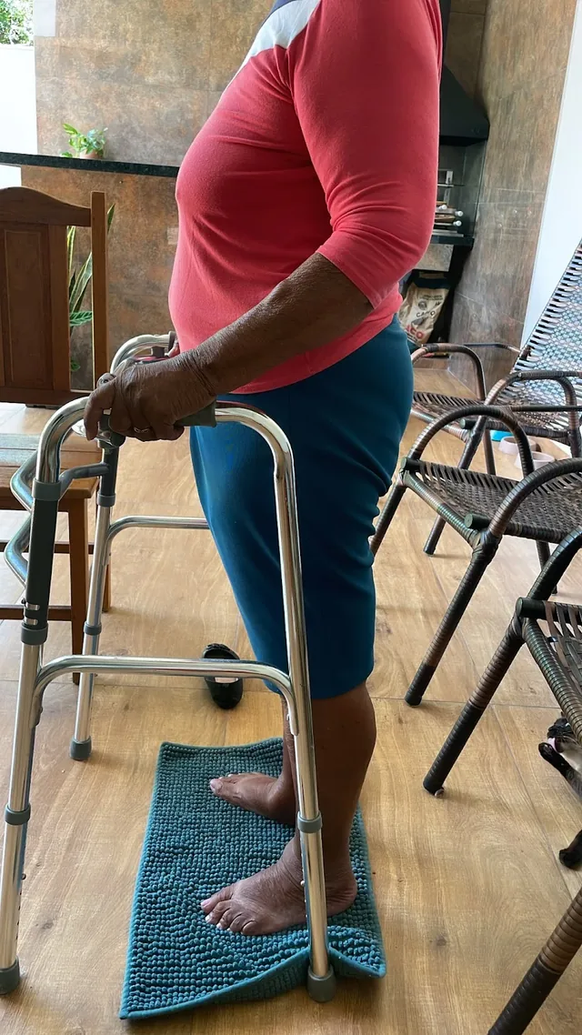 Paciente em pé sobre uma almofada de equilíbrio, apoiado num andador, na varanda de casa